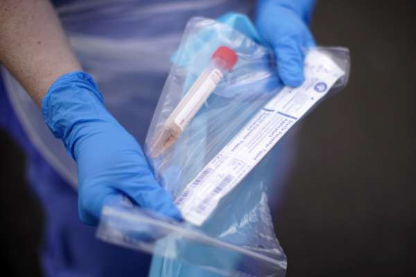 Covid-19 pasaulyje: per dieną užsikrėtė daugiau kaip 450 000 žmonių 1 COVID pasaulyje