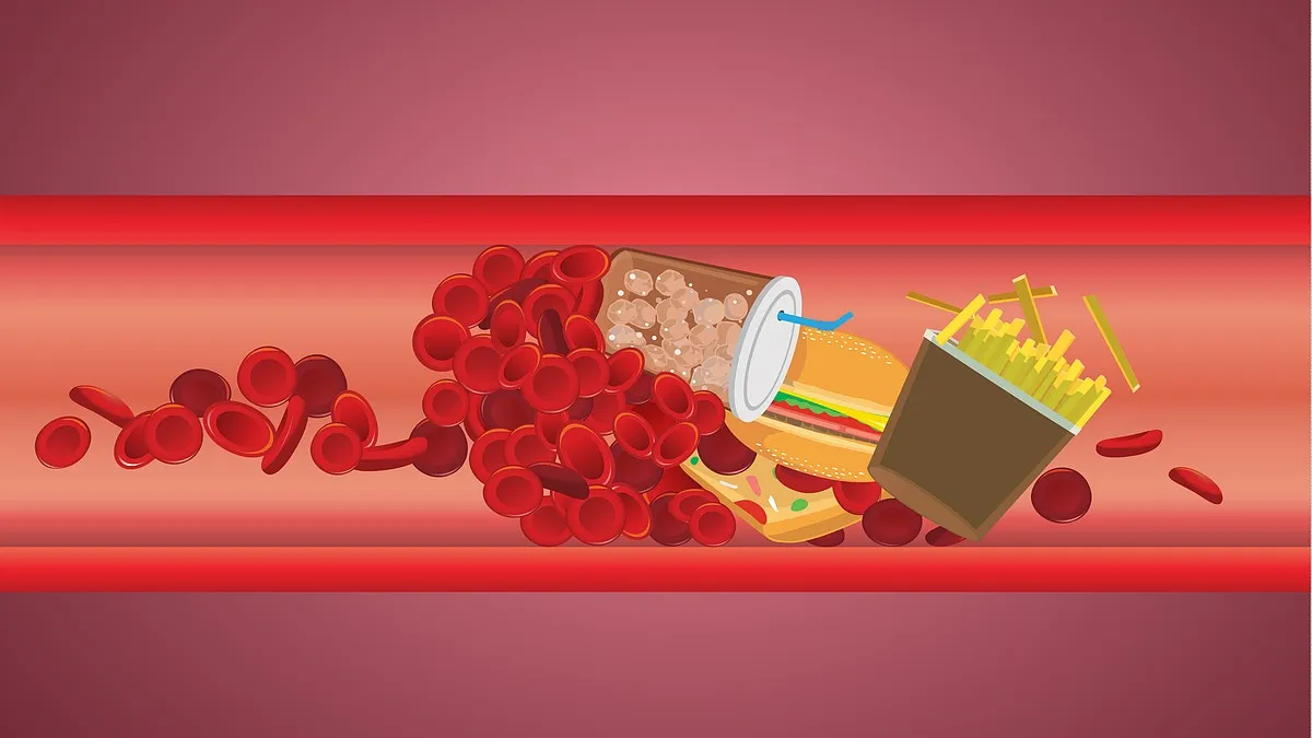 Didelis cholesterolio kiekis kraujyje