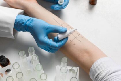 Išsityrus savo alergiją galima iš karto pradėti vartoti antialerginius vaistus_Shutterstock nuotr.