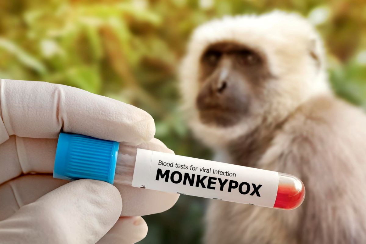 Mpox
