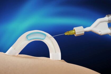 Specialus implantas vyrams