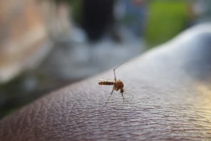 Niežulys po uodo įkandimo