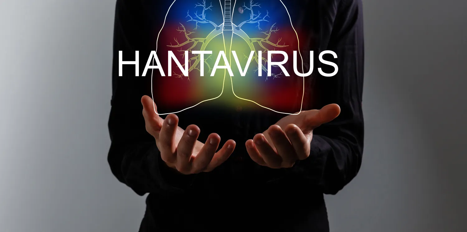 Hantavirusas