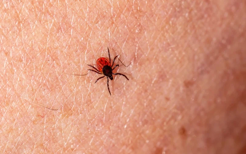 Po erkės įkandimo stebėkite šiuos 6 simptomus: kada delsti nebegalima