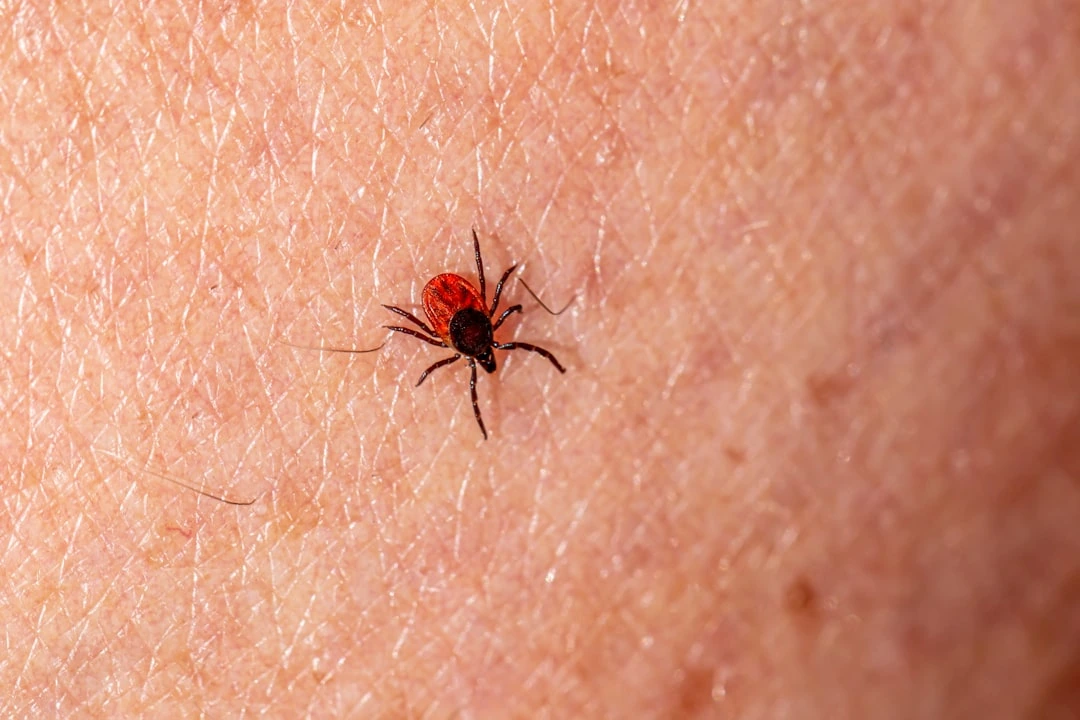 Po erkės įkandimo stebėkite šiuos 6 simptomus: kada delsti nebegalima