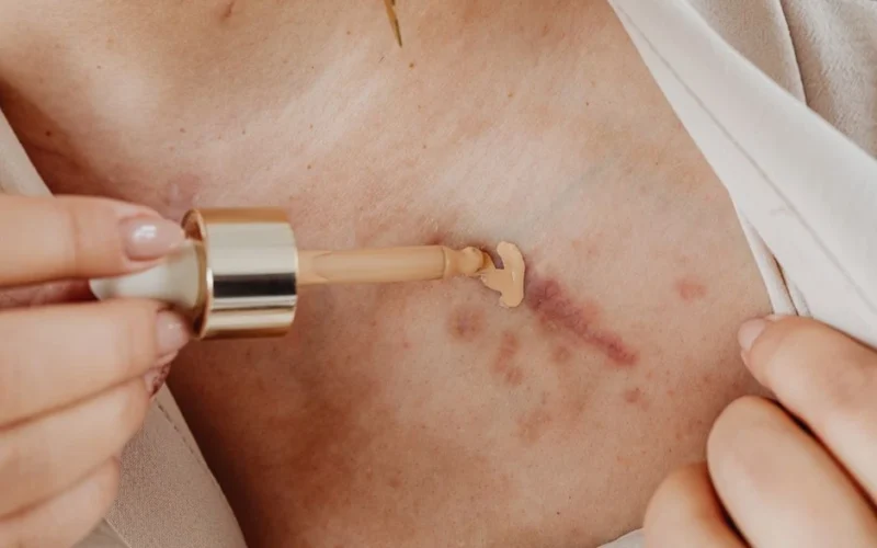 Randai neišnyksta per naktį: ką iš tiesų galima padaryti, kad jie taptų mažiau pastebimi