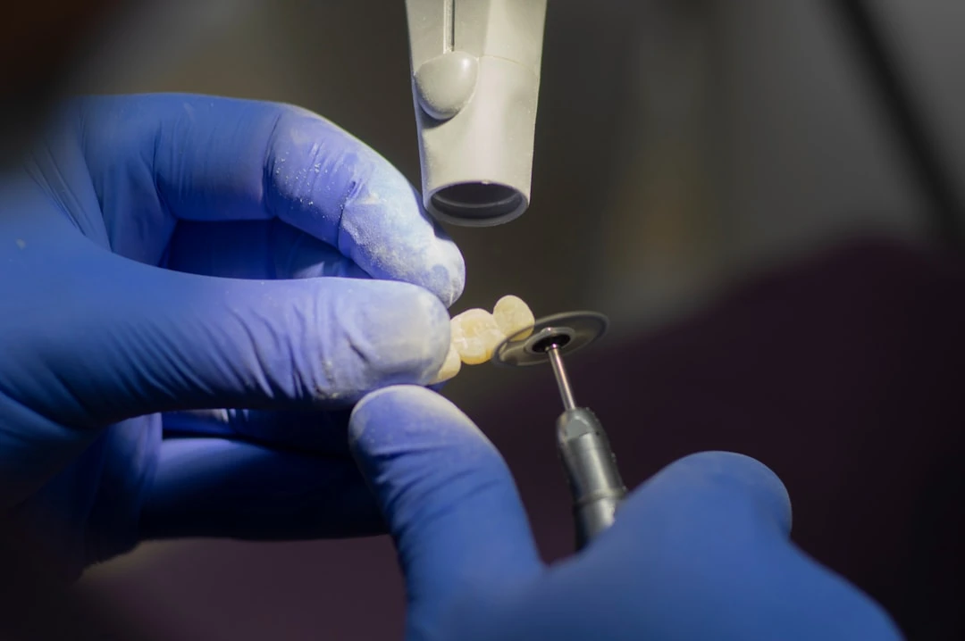 Ateities dantų karūnėlė galėtų būti atspausdinta 3D spausdintuvu per pusvalandį
