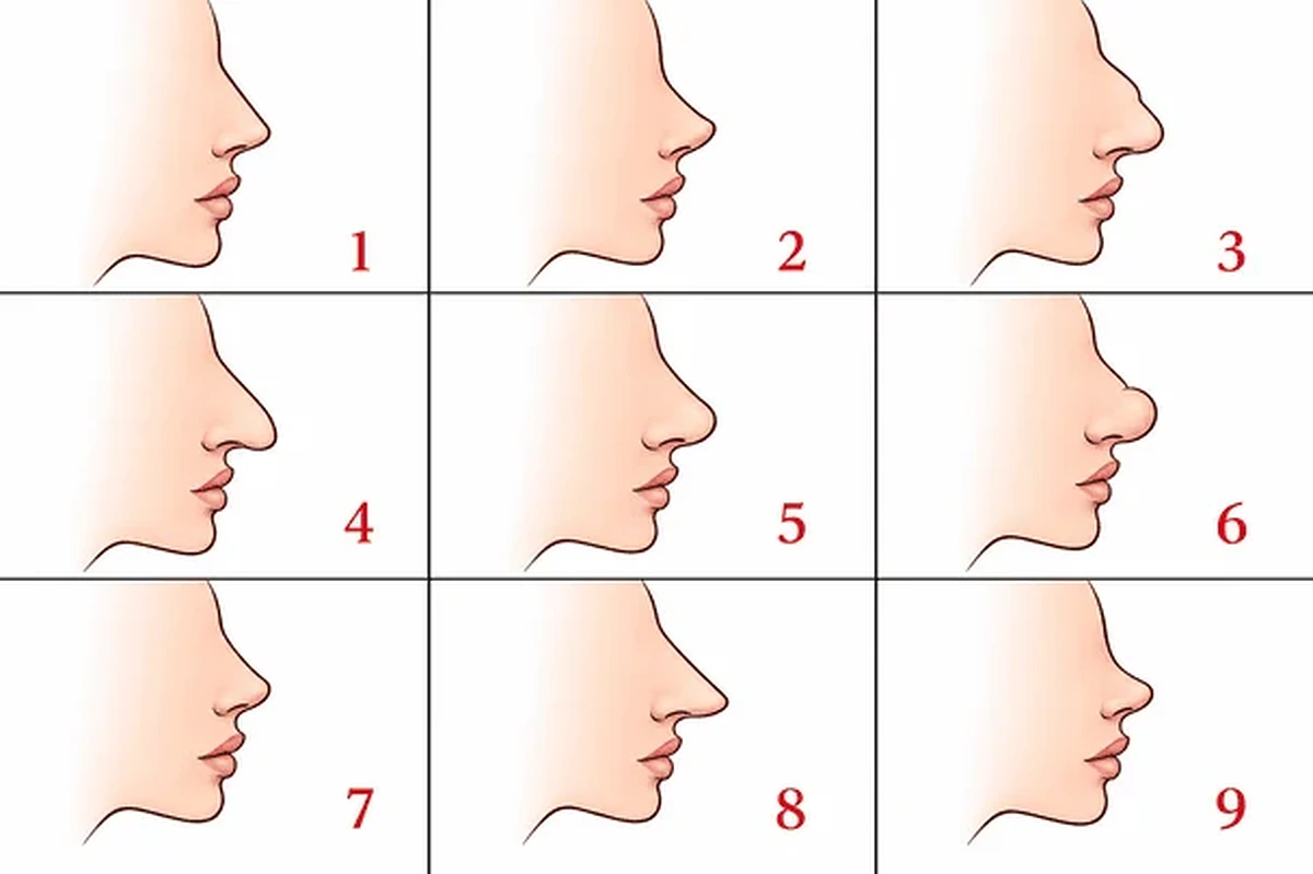 Nosies forma