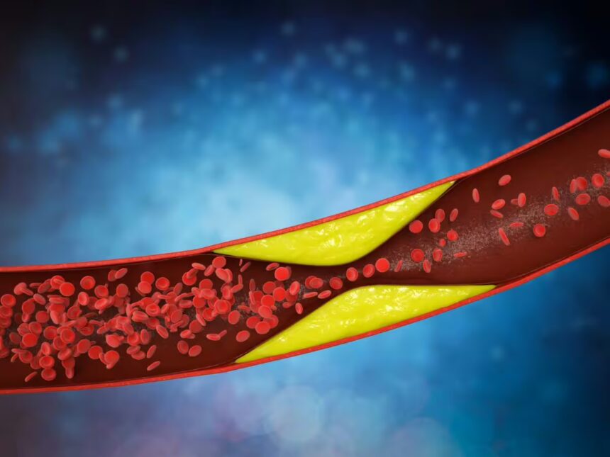 Cholesterolis