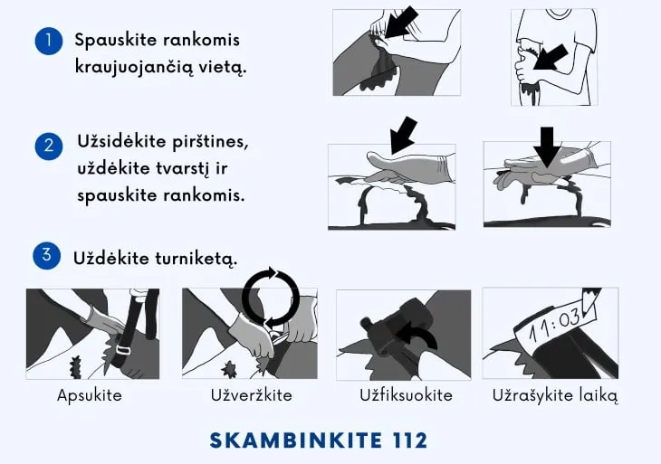 Kaip uždėti turniketą